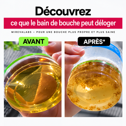 Mirevalabs Bain de Bouche Blanchissant Fraîcheur & Éclat
